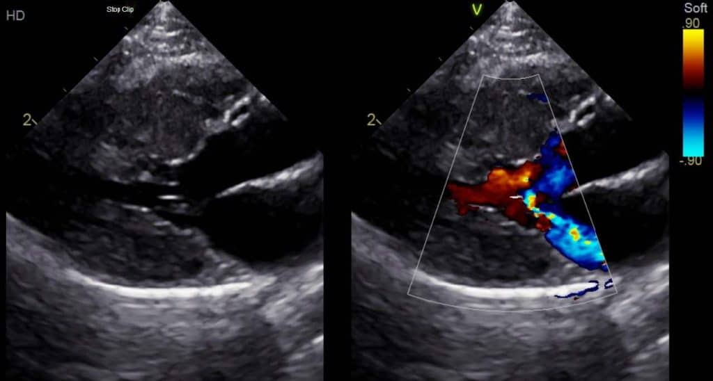 Diagnostic et le traitement des cardiomyopathies chez le chat OnlyVet à Lyon SaintPriest