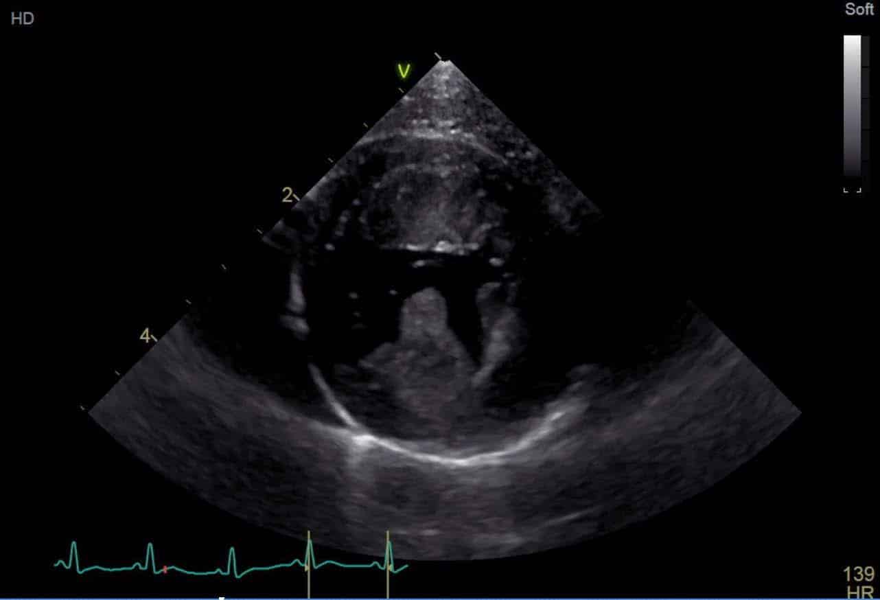 Diagnostic et le traitement des cardiomyopathies chez le chat ...