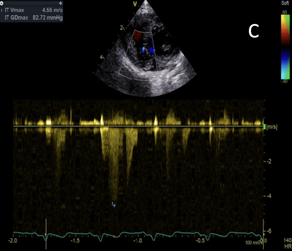 Images échocardiographiques – coupe apicale 4 cavités -OnlyVet Images échocardiographiques - coupe apicale 4 cavités -OnlyVet