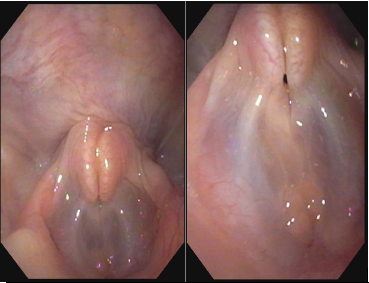 Examen endoscopique respiratoire d’un chat Examen endoscopique respiratoire d’un chat