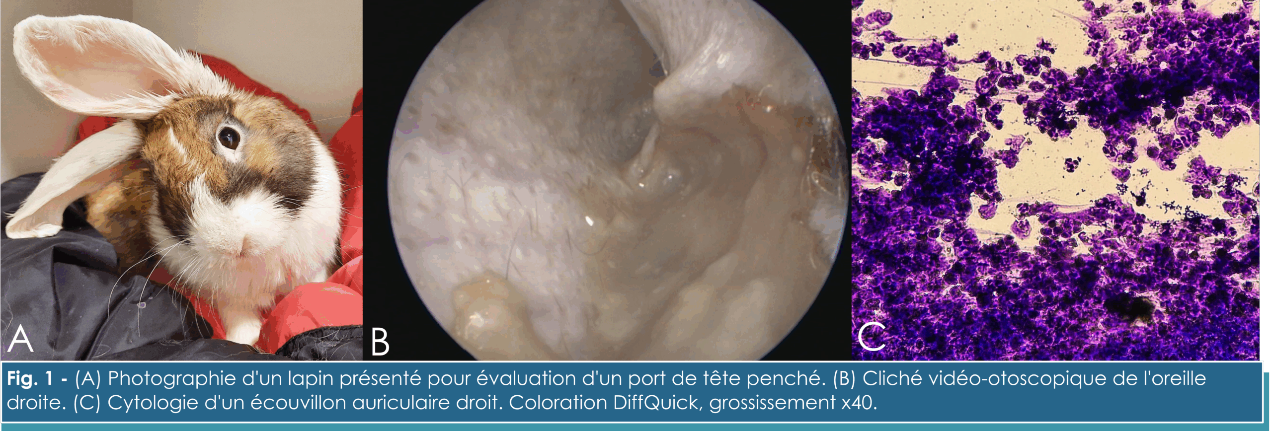 Fig. 1 Syndrome vestibulaire Fig. 1 Syndrome vestibulaire