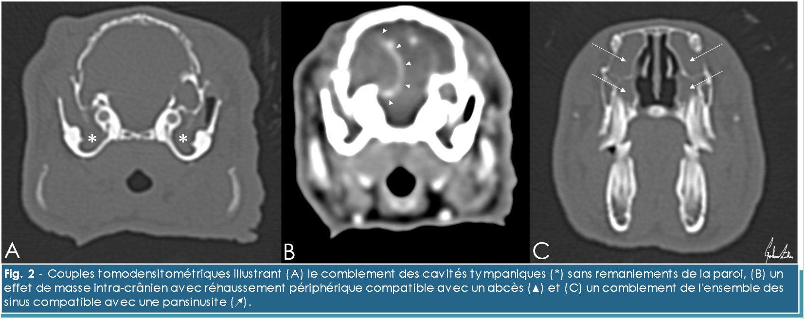 Fig. 2 syndrome vestibulaire Fig. 2 syndrome vestibulaire
