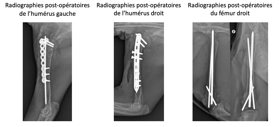 Radiographie humerus Radiographie humerus
